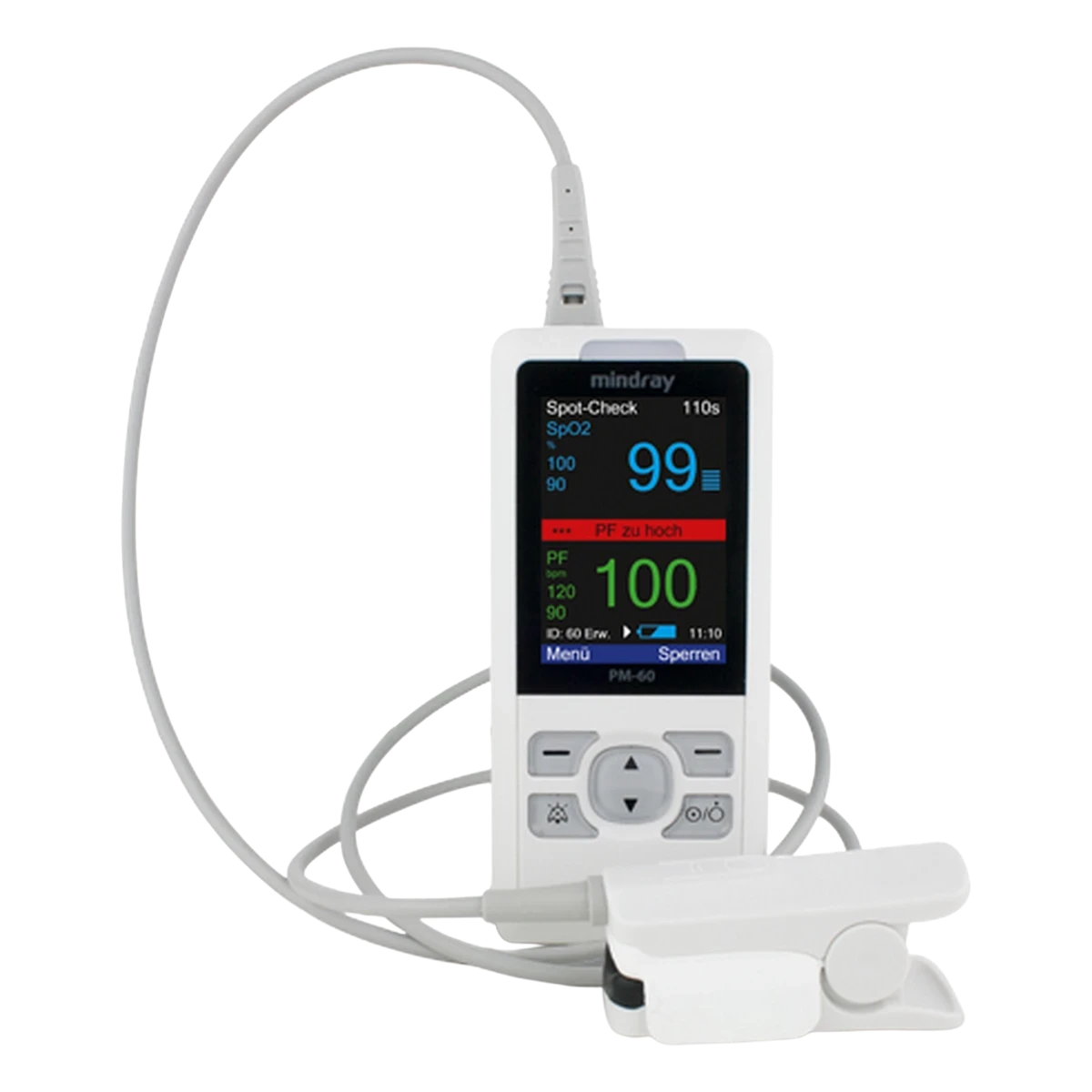 Mindray Pulsoximeter PM 60 inkl. Akku und Ladestation &ndash; Ansicht 2
